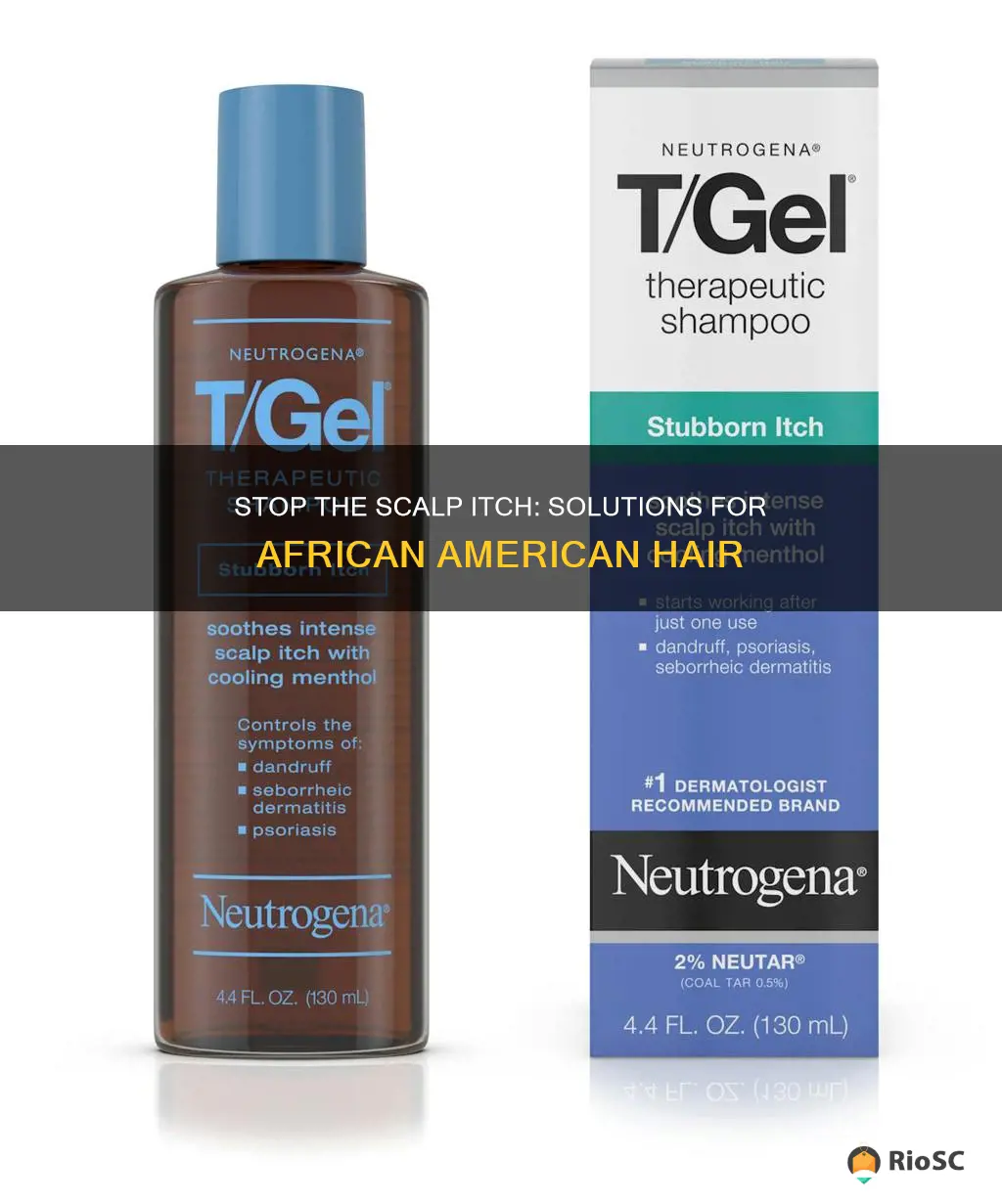 best anti scalp itch african american hair