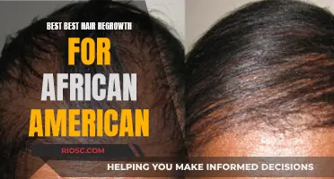 Natural Hair Restoration: Solutions for African American Hair Loss