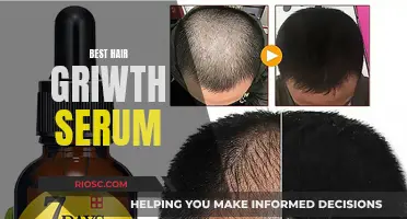 Unleash Luscious Locks: The Ultimate Hair Growth Serum Guide