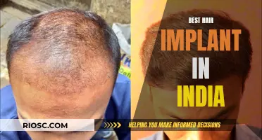 Natural Hair Restoration: India's Leading Implant Solutions