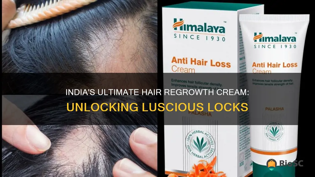 best hair regrowth cream in india