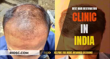 India's Leading Hair Restoration Clinic: Transforming Lives, One Strand at a Time