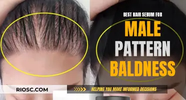 Male Pattern Baldness: The Power of Hair Serums