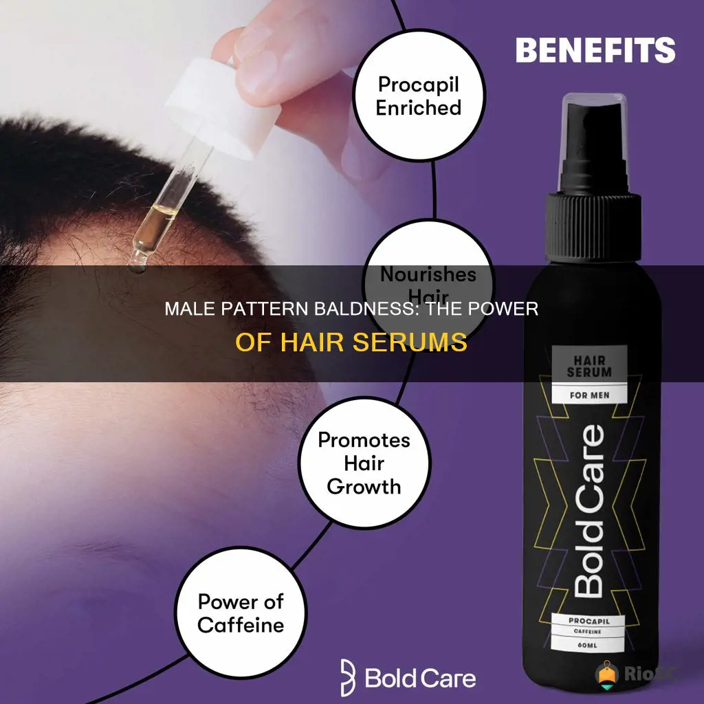 best hair serum for male pattern baldness