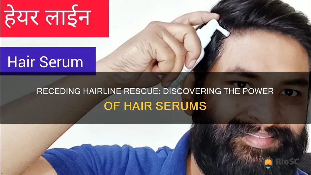 best hair serum for receding hairline