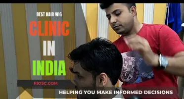 India's Top Hair Wig Clinic: Transforming Lives, One Strand at a Time