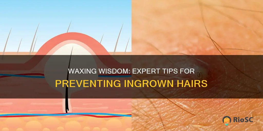 best ingrown hair prevention after waxing