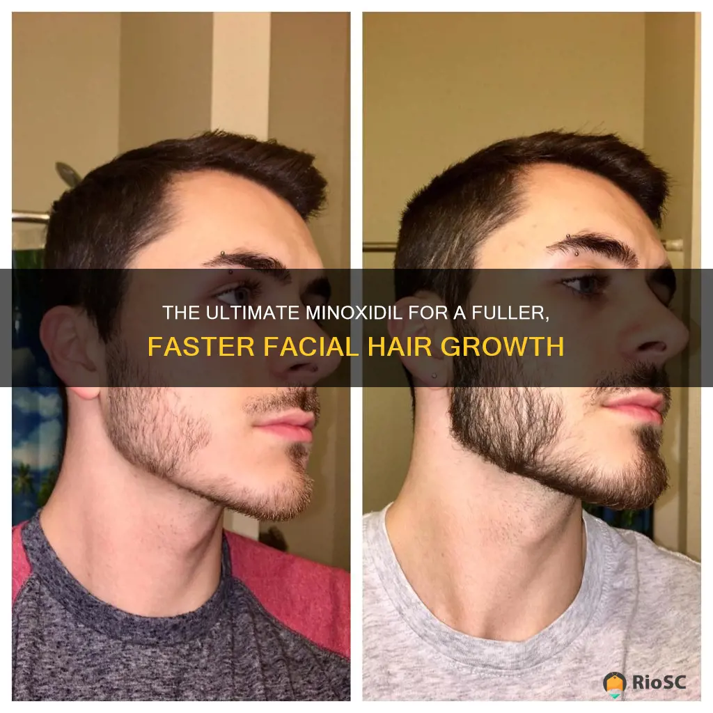 best minoxidil brand for facial hair